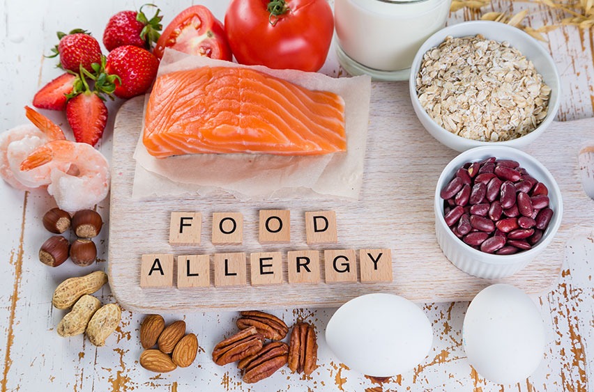 Food Intolerances and Allergies | Rory Hornstein | Registered Dietitian | Calgary and Surrounding Areas