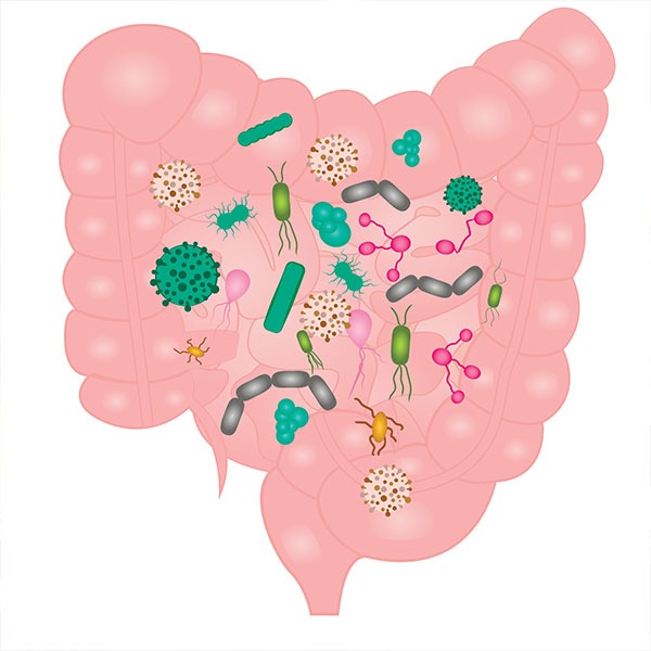 Small Intestine Bacterial Overgrowth (SIBO) | Rory Hornstein | Registered Dietitian | Calgary and Surrounding Areas