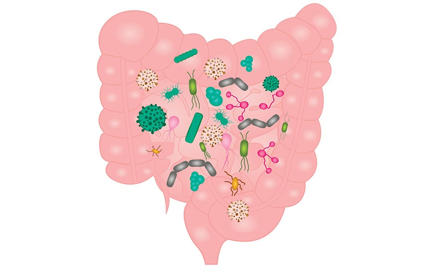 Small Intestine Bacterial Overgrowth (SIBO) | Rory Hornstein | Registered Dietitian | Calgary and Surrounding Areas