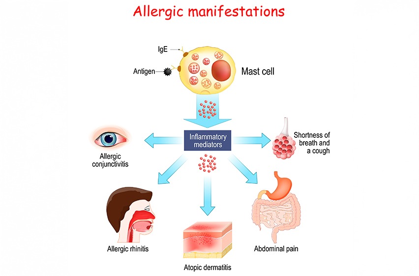 Gastrointestinal Nutrition Support | Rory Hornstein | Registered Dietitian | Calgary and Surrounding Areas